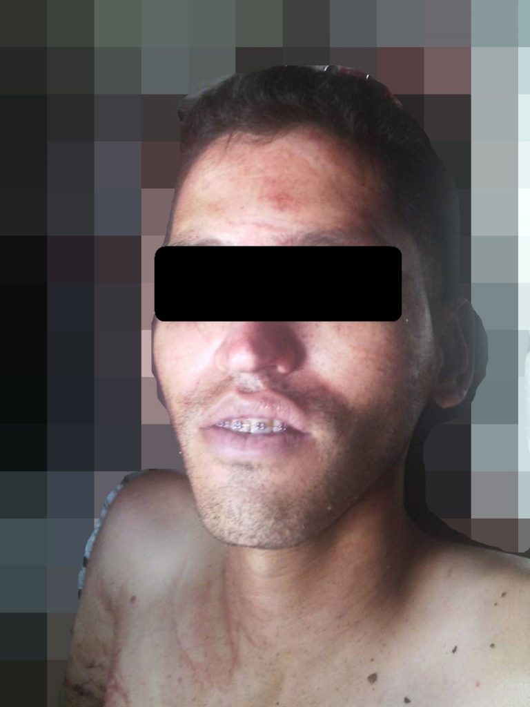 el atracador abatido, quedó identificado como Gamarra Torres Emigdio Enrique de 28 años de edad, era oriundo de Calabozo y residenciado en la urbanización Los Pinos.
