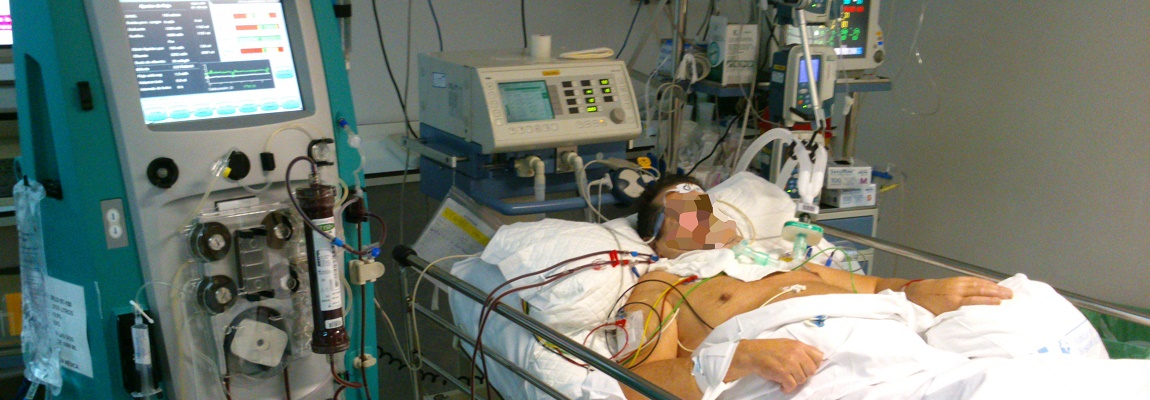 Hombre despierta tras 15 años en estado vegetativo, tras estimulación del nervio vago