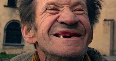 Venezolanos sin dientes, ante escasez de material odontológico