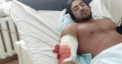 Por una septicemia, muere el fisicoculturista colombiano Rodolfo Alexis Torres Rojas, en Rusia