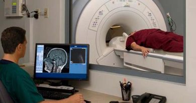 Las lesiones cerebrales pueden conllevar a cometer delitos