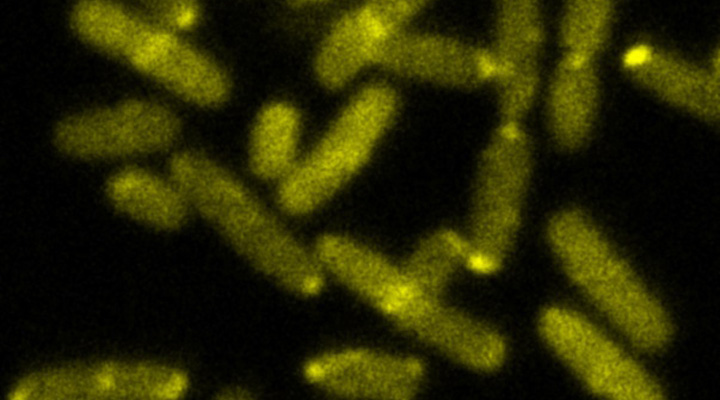La salmonella entérica, fue el mal que durante los años 1545 - 1550, mató a millones de indígenas de América