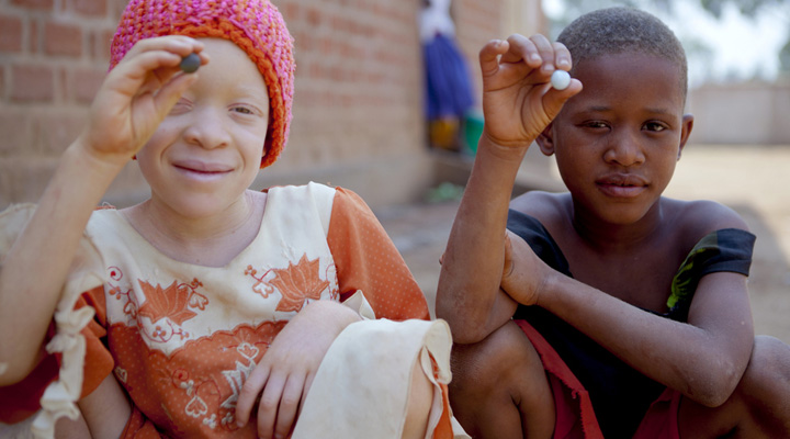 Raptan y matan a niño albino en Mozambique