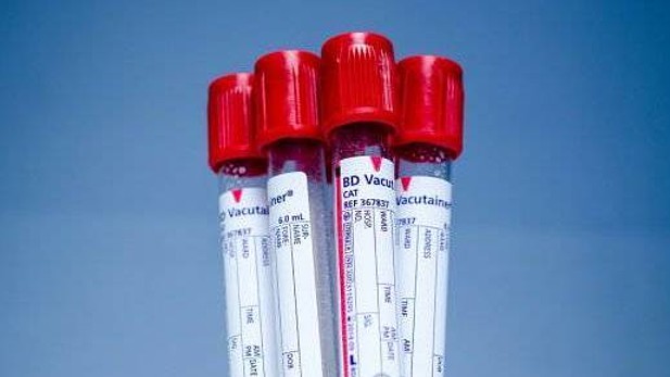 La prueba logró localizar dónde exáctamente se estaba desarrollando el cáncer de ovario, hígado, estómago, páncreas y esófago, en el 83 por ciento de los casos