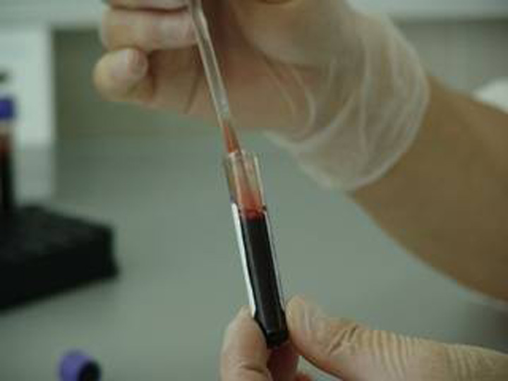 Tecnología permite detectar de forma temprana ocho tipos de cáncer